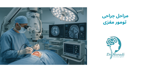 مراحل جراحی تومور مغزی
