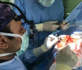 نمونه جراحی کیست آراکنوئید توسط دکتر مرادی
محل و اندازه این کیست شایع نمی باشد . بیمار با شکایت ضعف پیشرونده دست و پای راست مراجعه نموده بود که با استفاده از میکروسکوپ تحت عمل تخلیه کیست قرار گرفت . پس از عمل علائم بیمار بهبود یافت و در پیگیری یکساله عود کیست نداشته است