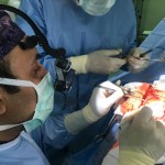 نمونه جراحی کیست آراکنوئید توسط دکتر مرادی
محل و اندازه این کیست شایع نمی باشد . بیمار با شکایت ضعف پیشرونده دست و پای راست مراجعه نموده بود که با استفاده از میکروسکوپ تحت عمل تخلیه کیست قرار گرفت . پس از عمل علائم بیمار بهبود یافت و در پیگیری یکساله عود کیست نداشته است
