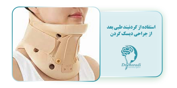 استفاده از گردنبند طبی بعد از جراحی دیسک گردن