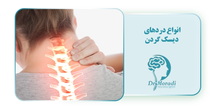 انواع دردهای دیسک گردن