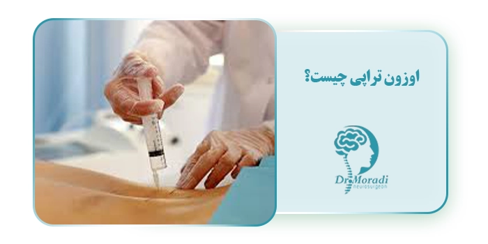 اوزون تراپی چیست؟