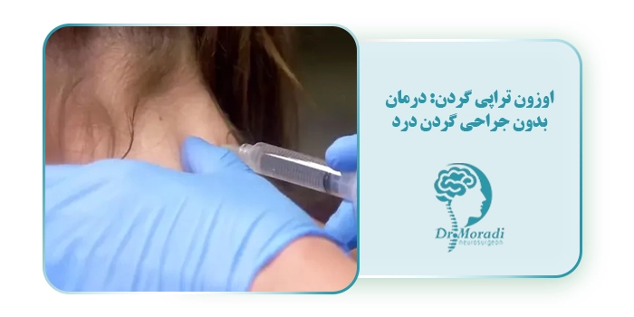 اوزون تراپی گردن: درمان بدون جراحی گردن درد