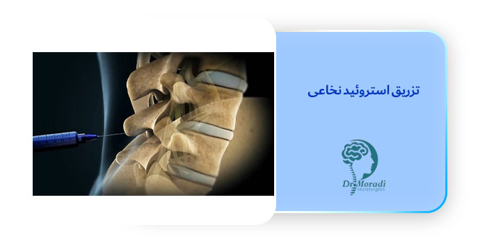 تزریق استروئید نخاعی