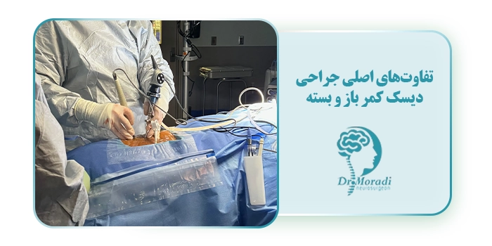 تفاوت جراحی دیسک کمر با لیزر و جراحی باز