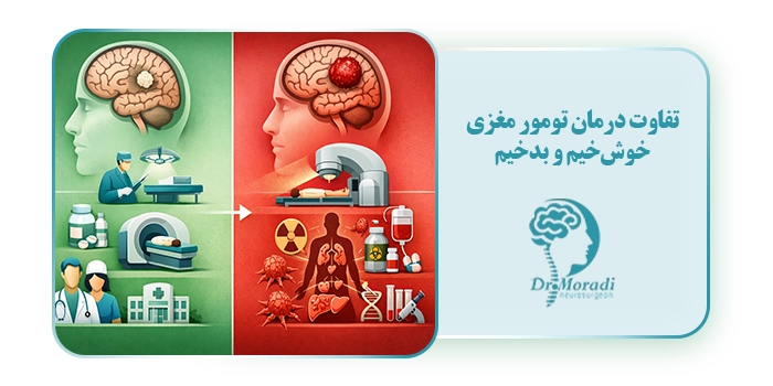 تفاوت درمان تومور مغزی خوش‌خیم و بدخیم