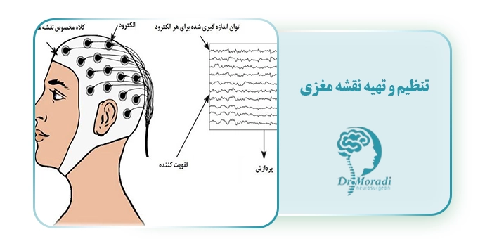 تنظیم و تهیه نقشه مغزی