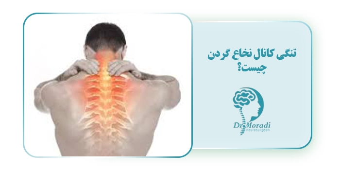 تنگی کانال نخاع گردن چیست؟