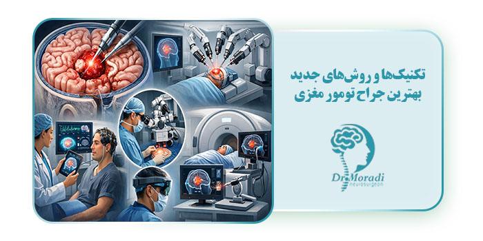 تکنیک‌ها و روش‌های جدید بهترین جراح تومور مغزی