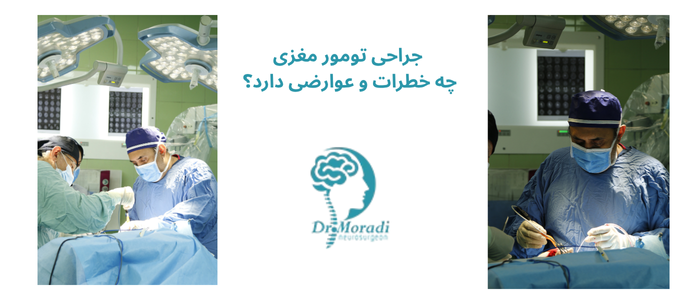 جراحی تومور مغزی چه خطرات و عوارضی دارد؟