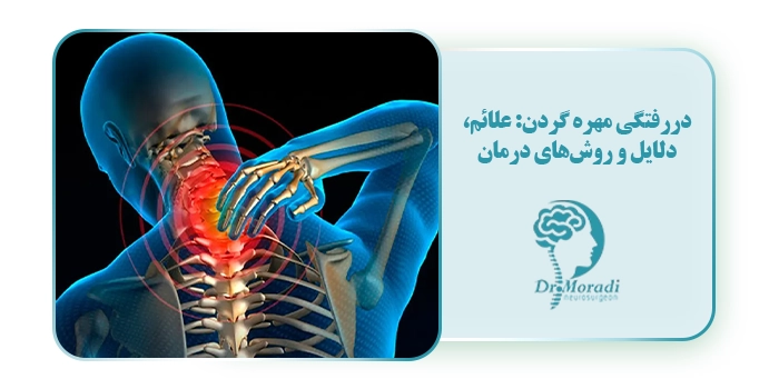 دررفتگی مهره گردن: علائم، دلایل و روش‌های درمان