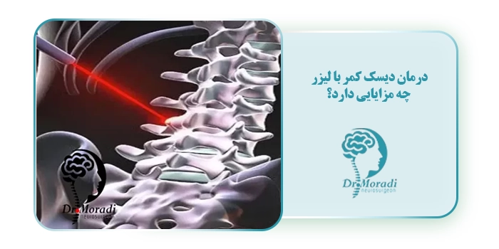 درمان دیسک کمر با لیزر
 چه مزایایی دارد؟