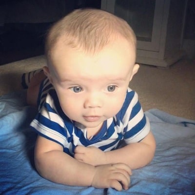 درمان زود بسته شدن ملاج نوزاد