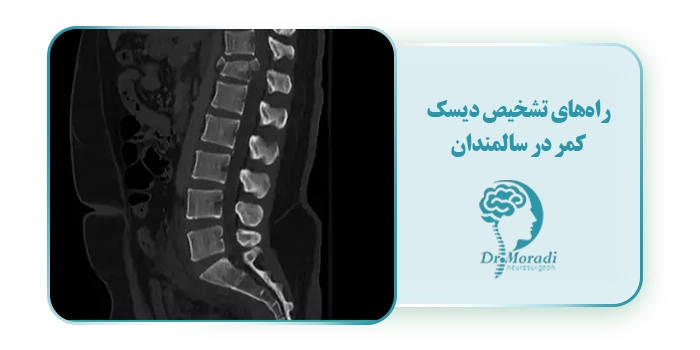 راه‌های تشخیص دیسک کمر در سالمندان