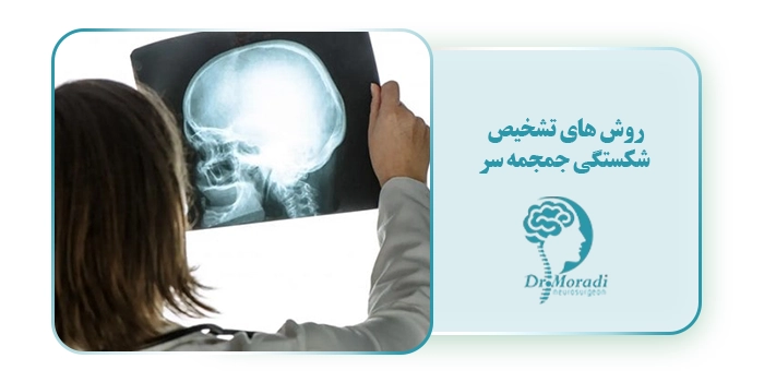 روش های تشخیص شکستگی جمجمه سر