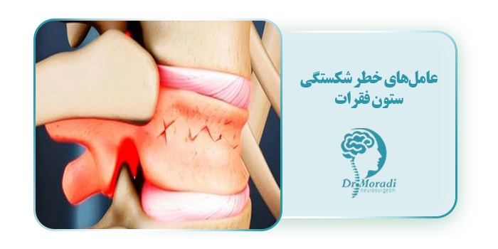 عامل‌های خطر شکستگی ستون فقرات
