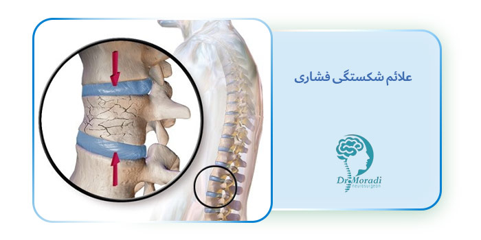 علائم شکستگی فشاری