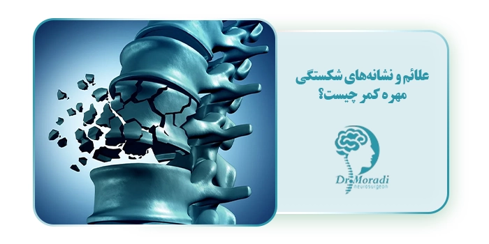 علائم و نشانه‌های شکستگی مهره کمر چیست؟