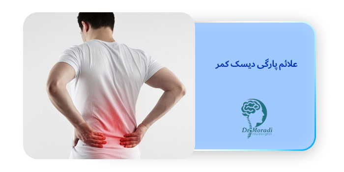 علائم پارگی دیسک کمر