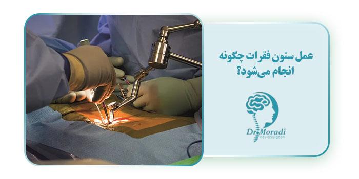 عمل ستون فقرات چگونه انجام می‌شود؟