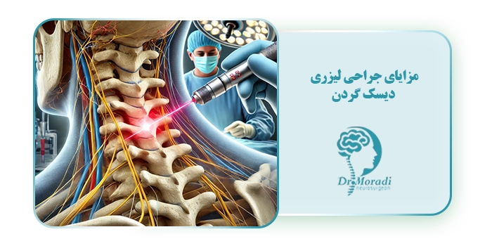 مزایای جراحی لیزری دیسک گردن