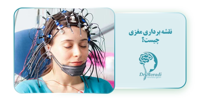 نقشه‌برداری مغزی چیست؟