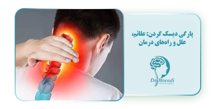 پارگی دیسک گردن: علائم، علل و راه‌های درمان