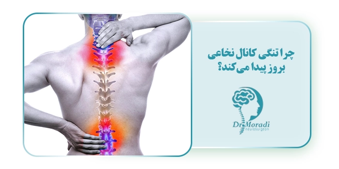 چرا تنگی کانال نخاعی بروز پیدا می‌کند؟