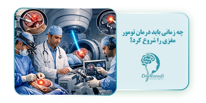 چه زمانی باید درمان تومور مغزی را شروع کرد؟