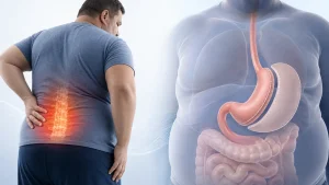 فواید اسلیو معده برای کاهش مشکلات ستون فقرات