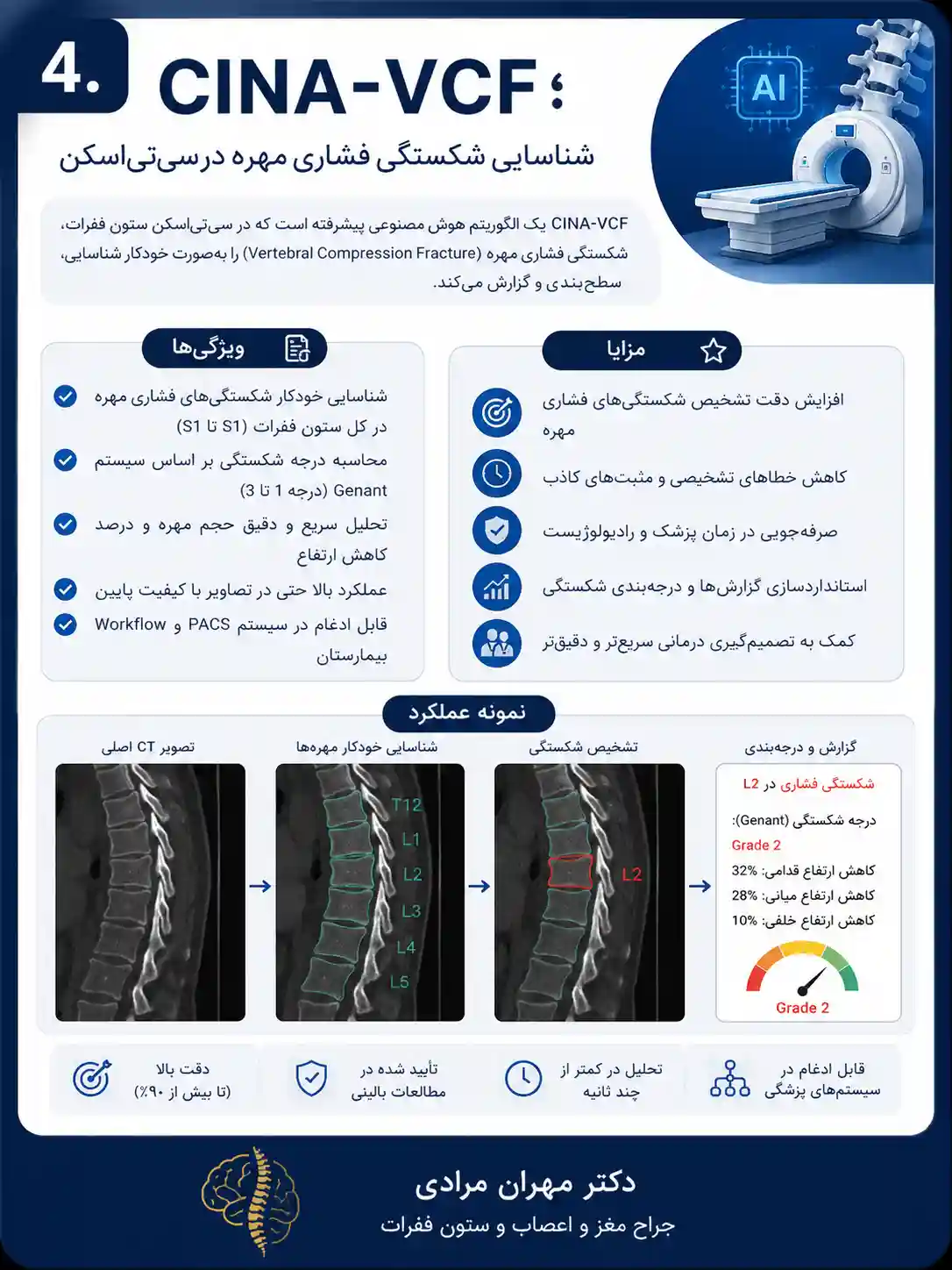 ۴. CINA-VCF؛ شناسایی شکستگی فشاری مهره در سیتیاسکن